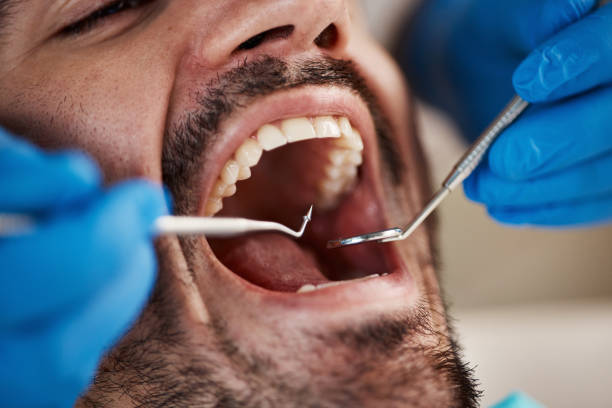 Best Broken Tooth Emergency  in Big Le, AK