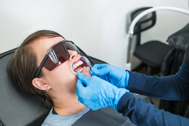 Teeth Whitening in AK