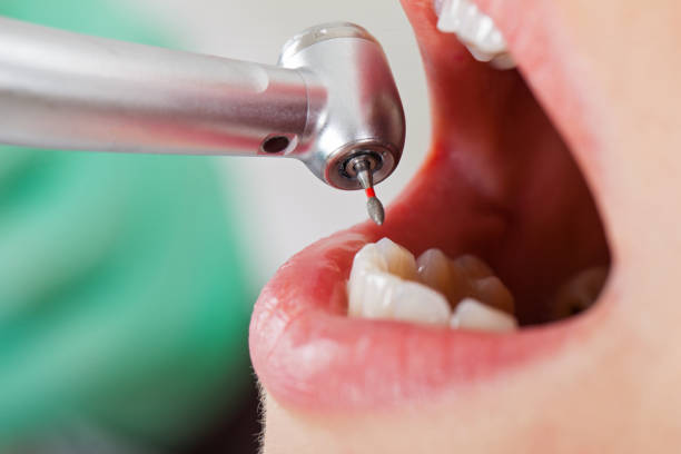 Best Dentist for Dental Trauma  in Big Le, AK
